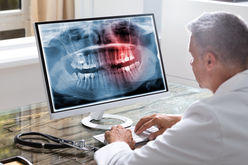 dentist typing on computer with dental x ray on screen